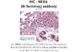 Image no. 2 for anti-NIMA (Never in Mitosis Gene A)-Related Kinase 6 (NEK6) (N-Term) antibody (ABIN1737252) (NEK6 Antikörper  (N-Term))