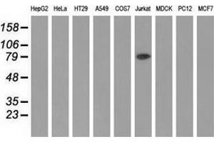 Western blot analysis of extracts (35 µg) from 9 different cell lines by using anti-ALDH1L1 monoclonal antibody. (ALDH1L1 Antikörper)