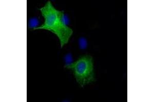 Image no. 6 for anti-B-Raf proto-oncogene, serine/threonine kinase (BRAF) antibody (ABIN1496952) (BRAF Antikörper)