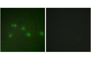 Immunofluorescence (IF) image for anti-Nuclear Receptor Subfamily 2, Group F, Member 2 (NR2F2) (AA 1-50) antibody (ABIN2889431) (NR2F2 Antikörper  (AA 1-50))