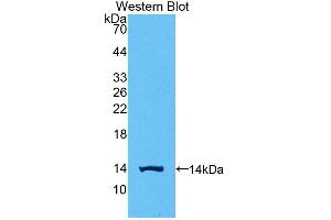 Western blot analysis of the recombinant protein. (CGB Antikörper  (AA 55-153))