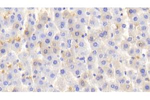 Detection of HB in Rat Liver Tissue using Polyclonal Antibody to Hemoglobin (HB)