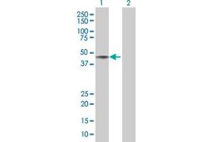 Lane 1: APEX1 transfected lysate ( 34.