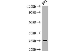 Western Blot Positive WB detected in: 293 whole cell lysate All lanes: Mad2L2 antibody at 1:2000 Secondary Goat polyclonal to rabbit IgG at 1/50000 dilution Predicted band size: 25 kDa Observed band size: 25 kDa (Rekombinanter MAD2L2 Antikörper)