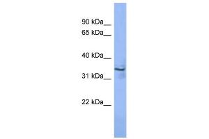 WB Suggested Anti-MAGEA2 Antibody Titration: 0. (MAGEA2 Antikörper  (N-Term))