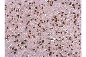 IHC-P Image Scaffold attachment factor B1 antibody detects Scaffold attachment factor B1 protein at nucleus on mouse fore brain by immunohistochemical analysis. (SAFB Antikörper)