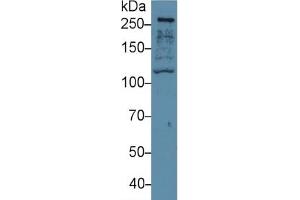 Western Blotting (WB) image for Filamin B, beta (FLNB) ELISA Kit (ABIN6574321)