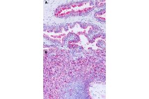 Immunohistochemical staining of formalin-fixed paraffin-embedded human prostate (A) and human spleen (B) with GPR63 polyclonal antibody . (GPR63 Antikörper  (Cytoplasmic Domain))