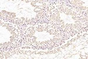 Immunohistochemistry analysis of paraffin-embedded rat testis using,NXF2 (ABIN7074901) at dilution of 1: 3000