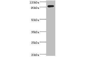 Western blot All lanes: SEMA4C antibody at 10 μg/mL + k562 whole cell lysate Secondary Goat polyclonal to rabbit IgG at 1/10000 dilution Predicted band size: 93 kDa Observed band size: 93 kDa (SEMA4C Antikörper  (AA 749-833))