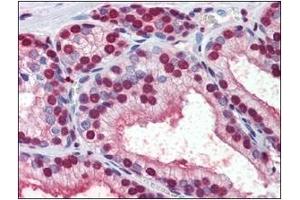 Immunohistochemistry (IHC) image for anti-Cellular Retinoic Acid Binding Protein 1 (CRABP1) (AA 1-137), (N-Term) antibody (ABIN400870) (CRABP1 Antikörper  (N-Term))