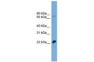 SLC5A5 antibody used at 1 ug/ml to detect target protein. (SLC5A5 Antikörper)