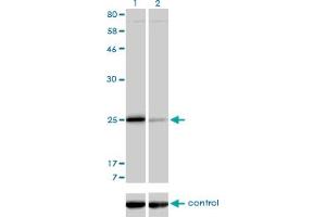 Western blot analysis of TNNI3 over-expressed 293 cell line, cotransfected with TNNI3 Validated Chimera RNAi (Lane 2) or non-transfected control (Lane 1). (TNNI3 Antikörper  (AA 102-210))