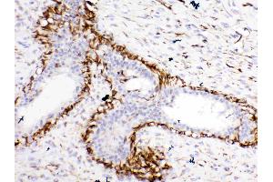 Immunohistochemistry (IHC) image for anti-BCL2-Like 1 (BCL2L1) (AA 1-219) antibody (ABIN5518741)