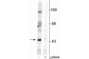 Western blot of rat testes lysate showing specific immunolabeling of the ~46 kDa EphrinB phosphorylated at Tyr331 in the first lane (-). (EPH Receptor B2 Antikörper  (pTyr331))
