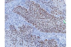 IHC analysis of YY1 using anti-YY1 antibody (ABIN7602999).