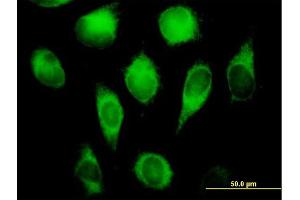 Immunofluorescence of purified MaxPab antibody to CYB5R3 on HeLa cell.