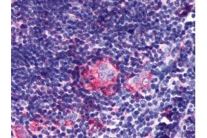 Immunohistochemical staining of Thymus using anti- P2RY5 antibody ABIN122464 (LPAR6 Antikörper)