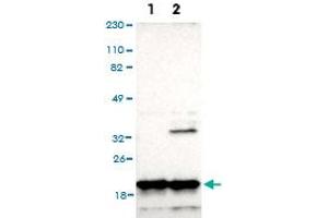 Western Blot analysis of (1) Human RT-4 cell, (2) Human U-251MG sp cell. (NDUFB8 Antikörper)