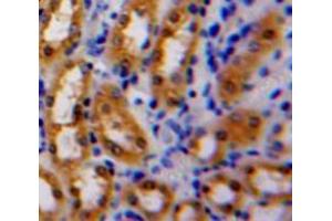 Used in DAB staining on fromalin fixed paraffin-embedded Kidney tissue (Latexin Antikörper  (AA 1-222))