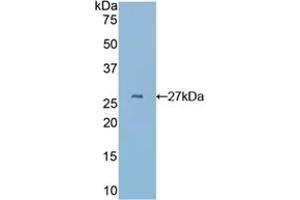 Detection of Recombinant CYR61, Mouse using Polyclonal Antibody to Cysteine Rich Protein, Angiogenic Inducer 61 (CYR61) (CYR61 Antikörper  (AA 176-379))
