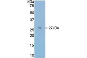 Detection of Recombinant CYR61, Mouse using Polyclonal Antibody to Cysteine Rich Protein, Angiogenic Inducer 61 (CYR61)