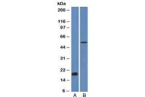 Western blot analysis A) partial recombinant protein B) human stomach lysate using E-Cadherin antibody (CDH1/1525).