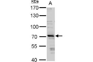WB Image TRIM32 antibody detects TRIM32 protein by western blot analysis. (TRIM32 Antikörper)