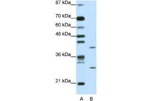 WB Suggested Anti-ZFP36L1 Antibody Titration: 1. (ZFP36L1 Antikörper  (N-Term))