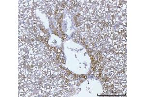 IHC analysis of ECHS1 using anti-ECHS1 antibody (ABIN7599813).