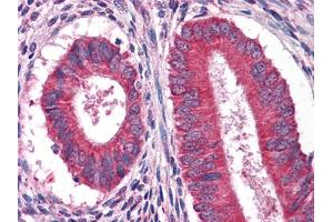 Immunohistochemical analysis of paraffin-embedded human Uterus tissues using anFtEG mouse mAb (EGF Antikörper)