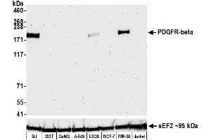 Western Blotting (WB) image for anti-Platelet Derived Growth Factor Receptor beta (PDGFRB) (AA 33-532) antibody (ABIN7453377)