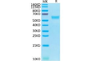 Human Fas on Tris-Bis PAGE under reduced condition. (FAS Protein (AA 26-173) (Fc Tag))