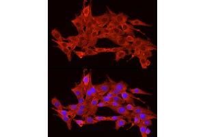 Immunofluorescence analysis of PC-12 cells using POMC Rabbit pAb (ABIN3017230, ABIN3017231, ABIN3017232 and ABIN6220004) at dilution of 1:200 (40x lens). (POMC Antikörper  (AA 1-267))