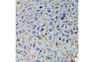 Immunohistochemistry of paraffin-embedded rat liver using RAF1 antibody. (RAF1 Antikörper)