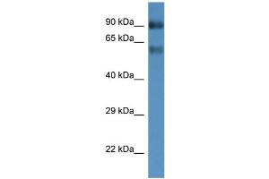 WB Suggested Anti-Slc6a15 Antibody   Titration: 1. (SLC6A15 Antikörper  (Middle Region))