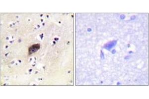 Immunohistochemistry (IHC) image for anti-P21-Activated Kinases 1/2/3 (PAK1/2/3) (AA 111-160), (pSer144) antibody (ABIN1531367)