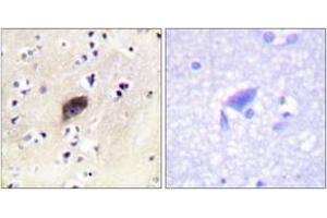 Immunohistochemistry analysis of paraffin-embedded human brain, using PAK1/2/3 (Phospho-Ser144/141/139) Antibody. (PAK1/2/3 Antikörper  (pSer144))