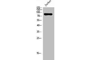 Western Blot analysis of Jurkat cells using Nox5 Polyclonal Antibody