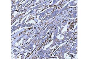IHC analysis of Hsp47/SERPINH1 using anti-Hsp47/SERPINH1 antibody (ABIN3043331).