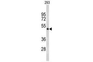 Western blot analysis of TPH2 Antibody (Center) in 293 cell line lysates (35 µg/lane). (Tryptophan Hydroxylase 2 Antikörper  (Middle Region))
