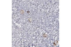 Immunohistochemical staining of human ovary with LACTB polyclonal antibody  shows strong granular cytoplasmic positivity in follicle cells at 1:200-1:500 dilution.