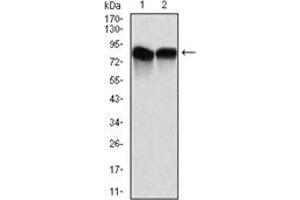 Western Blotting (WB) image for anti-Neural Precursor Cell Expressed, Developmentally Down-Regulated 8 (NEDD8) antibody (ABIN1108404) (NEDD8 Antikörper)