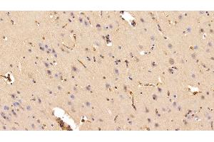 Immunohistochemistry (IHC) image for anti-Transferrin (TF) antibody (ABIN7430009)