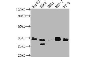 Western Blot Positive WB detected in: HepG2 whole cell lysate, K562 whole cell lysate, U251 whole cell lysate, MCF-7 whole cell lysate, PC-3 whole cell lysate All lanes: RPIA antibody at 1:2000 Secondary Goat polyclonal to rabbit IgG at 1/50000 dilution Predicted band size: 34 kDa Observed band size: 33 kDa (Ribose 5-Phosphate Isomerase A (RPIA) (AA 1-311) Antikörper)