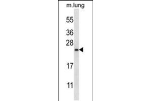 Western blot analysis in mouse lung tissue lysates (35ug/lane). (RHEBL1 Antikörper  (N-Term))