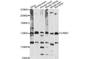 Western blot analysis of extracts of various cell lines, using CAND1 antibody (ABIN6291857) at 1:1000 dilution. (CAND1 Antikörper)