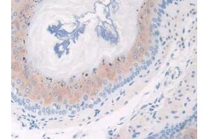 Used in DAB staining on fromalin fixed paraffin- embedded esophagus tissue (CFP Antikörper  (AA 54-217))