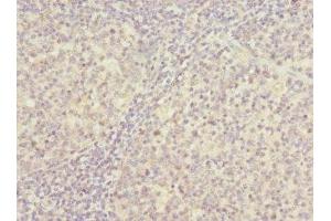 Immunohistochemistry (IHC) image for anti-Proteasome (Prosome, Macropain) 26S Subunit, Non-ATPase, 8 (PSMD8) (AA 101-350), (Regulatory Subunit 8) antibody (ABIN7142221)