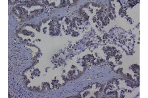 IHC analysis of NRF1 using anti-NRF1 antibody (ABIN6719347). (NRF1 Antikörper  (AA 246-503))